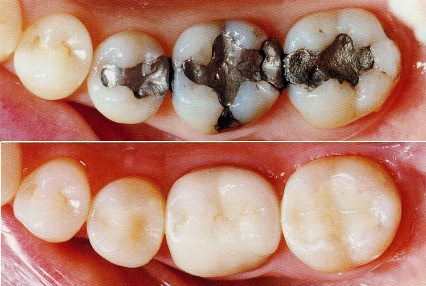 orthodontic services in gandhinagar