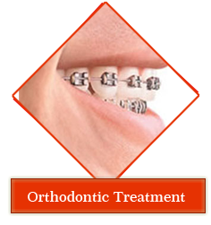 Dental jewellery treatment in Gandhinagar , Dental implants clinic in Gandhinagar , Smile Designing treatment in Gandhinagar , Orthodontic services in Gandhinagar , periodontal dentistry treatment in gandhinagar ,
 root canal treatment in gandhinagar , teeth whitening in gandhinagar , veneers,crown and bridges treatment in gandhinagar ,
 oral surgery in gandhinagar , maxillofacial surgery in gandhinagar