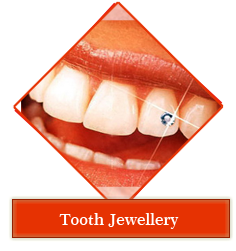 Dental jewellery treatment in Gandhinagar , Dental implants clinic in Gandhinagar , Smile Designing treatment in Gandhinagar , Orthodontic services in Gandhinagar , periodontal dentistry treatment in gandhinagar ,
 root canal treatment in gandhinagar , teeth whitening in gandhinagar , veneers,crown and bridges treatment in gandhinagar ,
 oral surgery in gandhinagar , maxillofacial surgery in gandhinagar