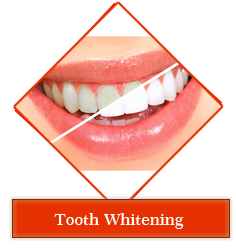 Dental jewellery treatment in Gandhinagar , Dental implants clinic in Gandhinagar , Smile Designing treatment in Gandhinagar , Orthodontic services in Gandhinagar , periodontal dentistry treatment in gandhinagar ,
 root canal treatment in gandhinagar , teeth whitening in gandhinagar , veneers,crown and bridges treatment in gandhinagar ,
 oral surgery in gandhinagar , maxillofacial surgery in gandhinagar