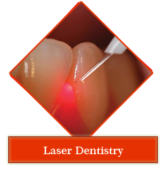 Dental jewellery treatment in Gandhinagar , Dental implants clinic in Gandhinagar , Smile Designing treatment in Gandhinagar , Orthodontic services in Gandhinagar , periodontal dentistry treatment in gandhinagar ,
 root canal treatment in gandhinagar , teeth whitening in gandhinagar , veneers,crown and bridges treatment in gandhinagar ,
 oral surgery in gandhinagar , maxillofacial surgery in gandhinagar