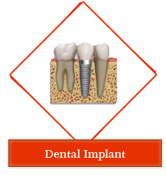 Dental jewellery treatment in Gandhinagar , Dental implants clinic in Gandhinagar , Smile Designing treatment in Gandhinagar , Orthodontic services in Gandhinagar , periodontal dentistry treatment in gandhinagar ,
 root canal treatment in gandhinagar , teeth whitening in gandhinagar , veneers,crown and bridges treatment in gandhinagar ,
 oral surgery in gandhinagar , maxillofacial surgery in gandhinagar