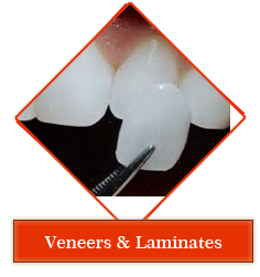 Dental jewellery treatment in Gandhinagar , Dental implants clinic in Gandhinagar , Smile Designing treatment in Gandhinagar , Orthodontic services in Gandhinagar , periodontal dentistry treatment in gandhinagar ,
 root canal treatment in gandhinagar , teeth whitening in gandhinagar , veneers,crown and bridges treatment in gandhinagar ,
 oral surgery in gandhinagar , maxillofacial surgery in gandhinagar