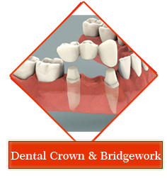 Dental jewellery treatment in Gandhinagar , Dental implants clinic in Gandhinagar , Smile Designing treatment in Gandhinagar , Orthodontic services in Gandhinagar , periodontal dentistry treatment in gandhinagar ,
 root canal treatment in gandhinagar , teeth whitening in gandhinagar , veneers,crown and bridges treatment in gandhinagar ,
 oral surgery in gandhinagar , maxillofacial surgery in gandhinagar