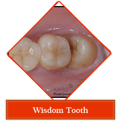 Dental jewellery treatment in Gandhinagar , Dental implants clinic in Gandhinagar , Smile Designing treatment in Gandhinagar , Orthodontic services in Gandhinagar , periodontal dentistry treatment in gandhinagar ,
 root canal treatment in gandhinagar , teeth whitening in gandhinagar , veneers,crown and bridges treatment in gandhinagar ,
 oral surgery in gandhinagar , maxillofacial surgery in gandhinagar